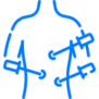 Laparoscopy Minimally invasive tools for precision surgery.